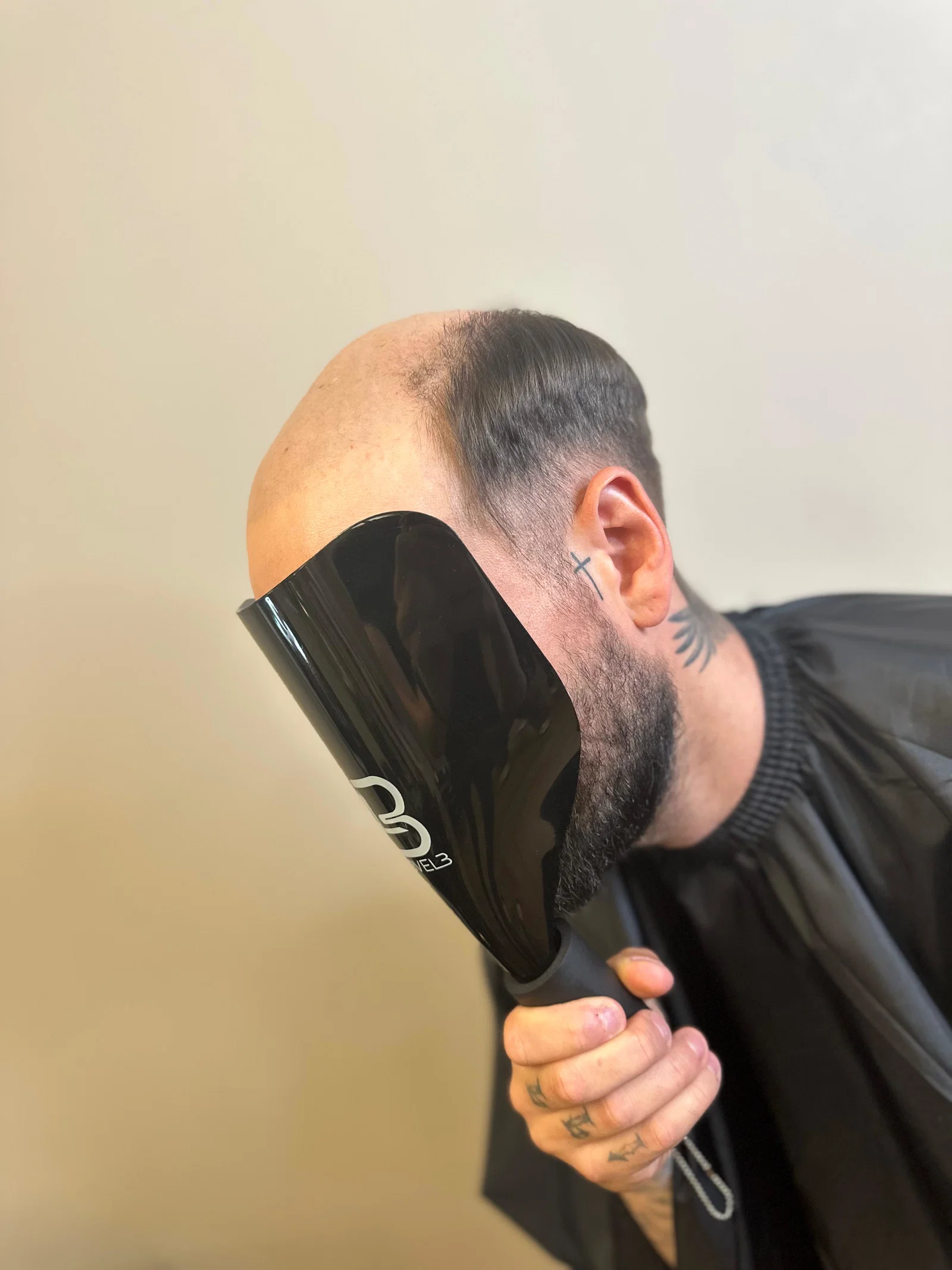 Hair Repair Club client before hair system