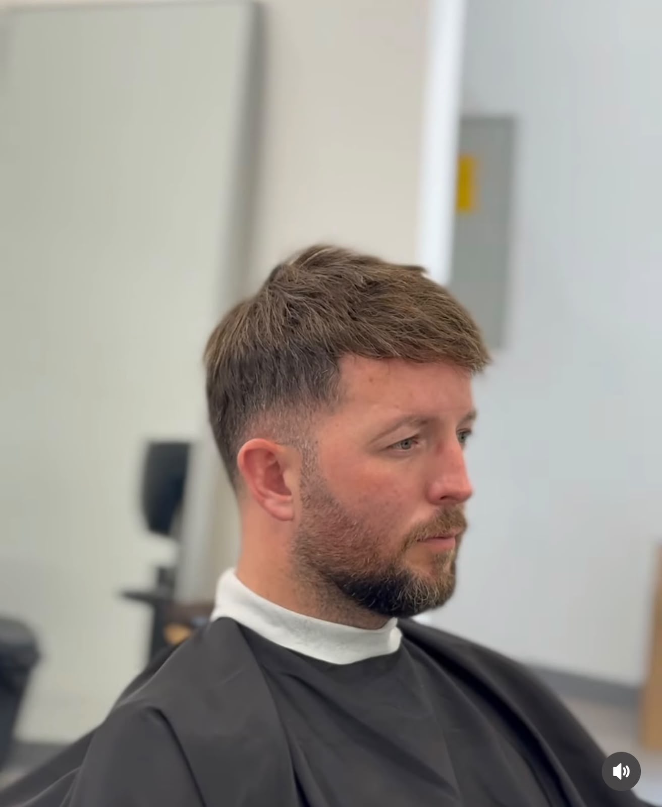 Hair Repair Club Dubai client after hair system, full natural-looking result