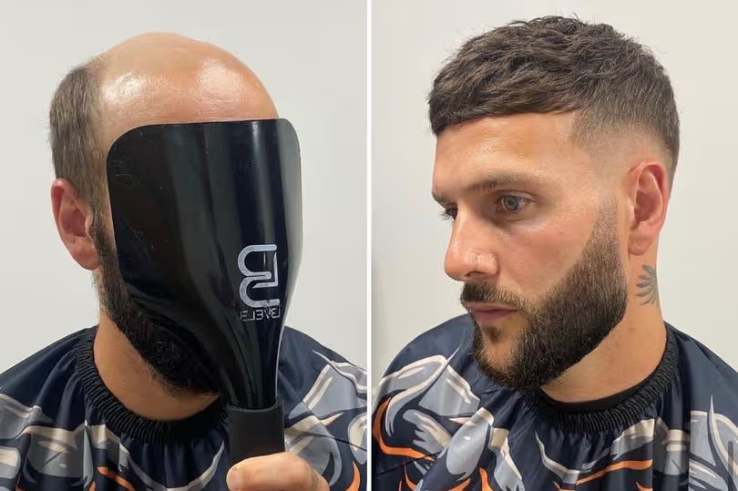 Genuine Hair Repair Club client before and after hair system transformation