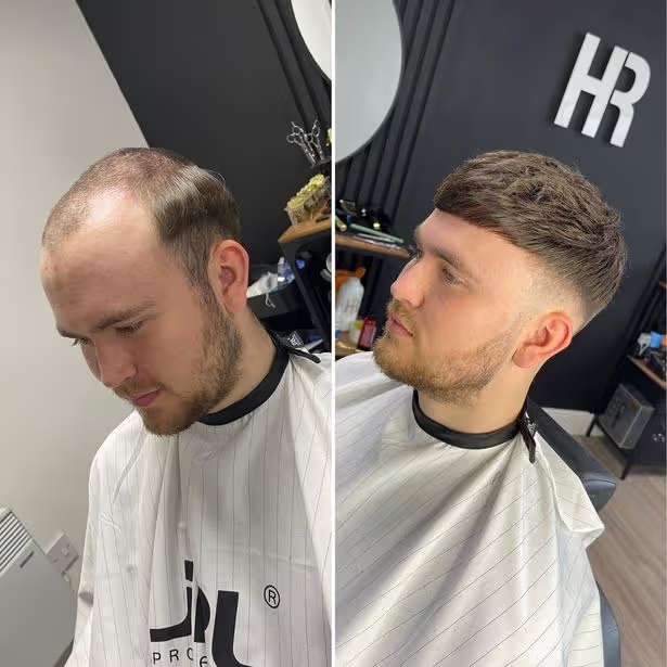 Genuine Hair Repair Club client before and after hair system transformation