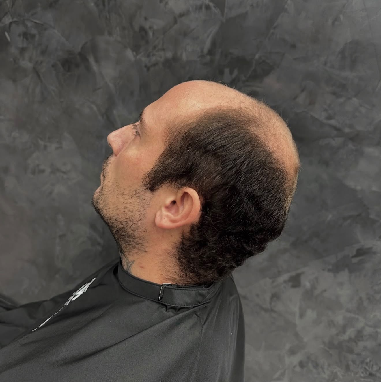 Hair Repair Club client before hair system