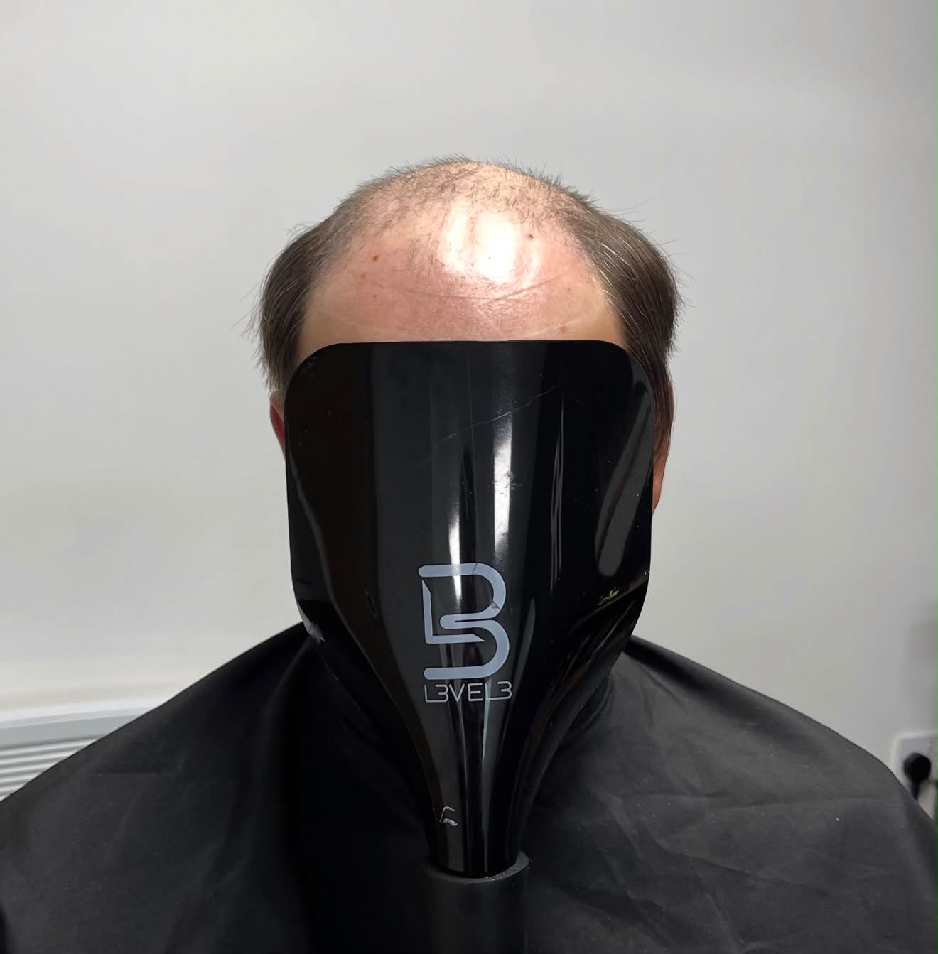 Hair Repair Club client before hair system